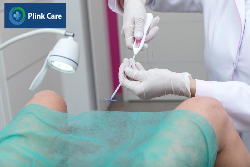 bác sĩ đang thực hiện thao tác đặt vòng tránh thai
