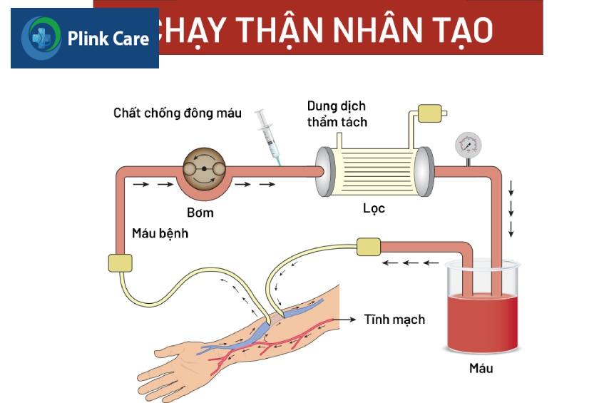 chạy thận nhân tạo