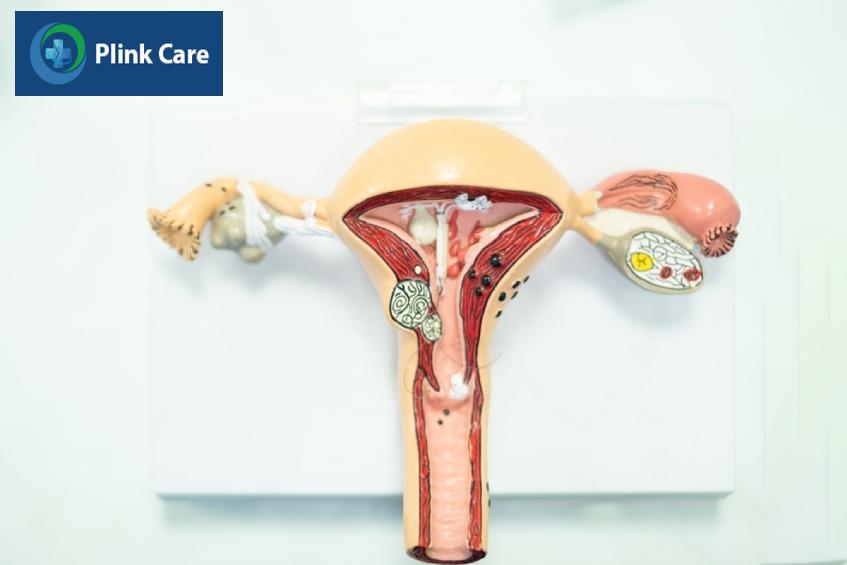 dẫn đến các bệnh phụ khoa khác