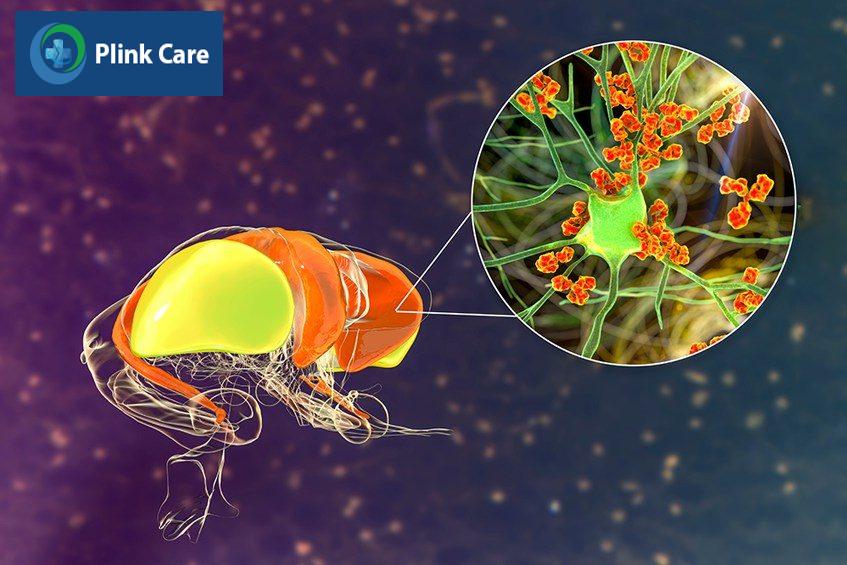 Vi khuẩn ăn thịt người là gì