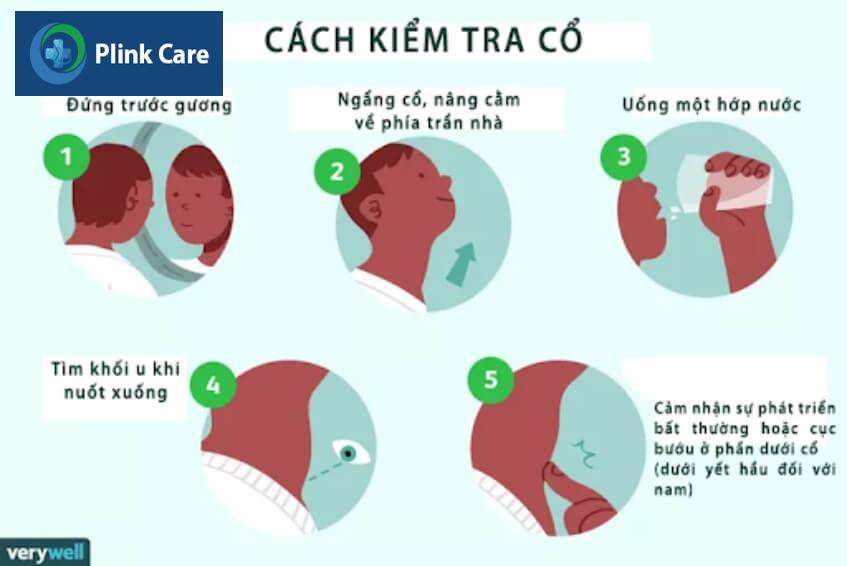 5 bước tự kiểm tra bướu cổ tại nhà