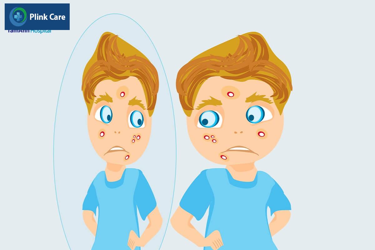 Dấu hiệu bé dậy thì sớm