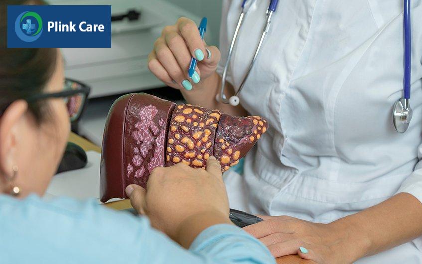 mức độ nguy hiểm của xơ gan