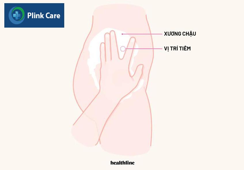 tiêm phần cơ trên ngoài của mông