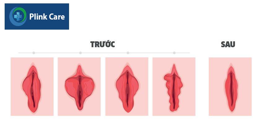 trước và sau khi thực hiện liệu trình