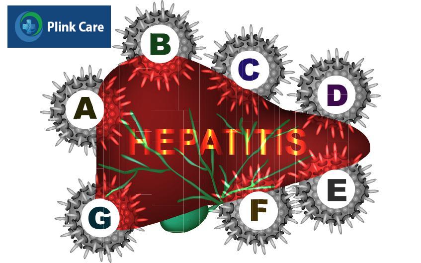 virus gây viêm gan