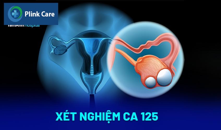 Xét nghiệm CA 125