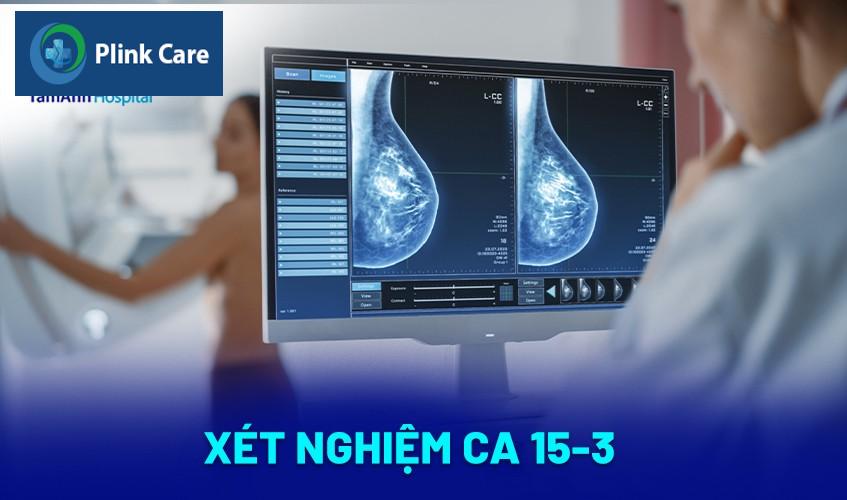 Xét nghiệm CA 15-3
