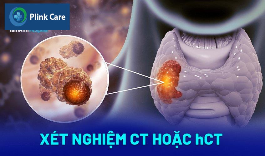 xét nghiệm ct hoặc hct