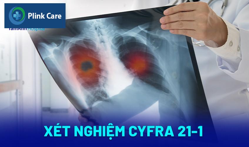 Xét nghiệm CYFRA 21-1