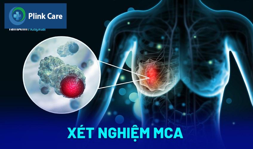 Xét nghiệm MCA