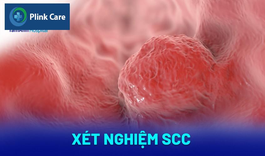 Xét nghiệm SCC (SCCA)