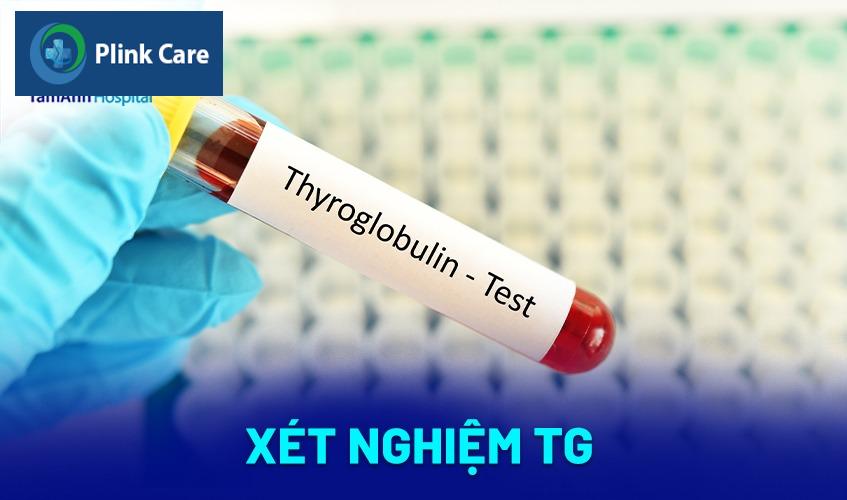 Xét nghiệm TG (Thyroglobulin)