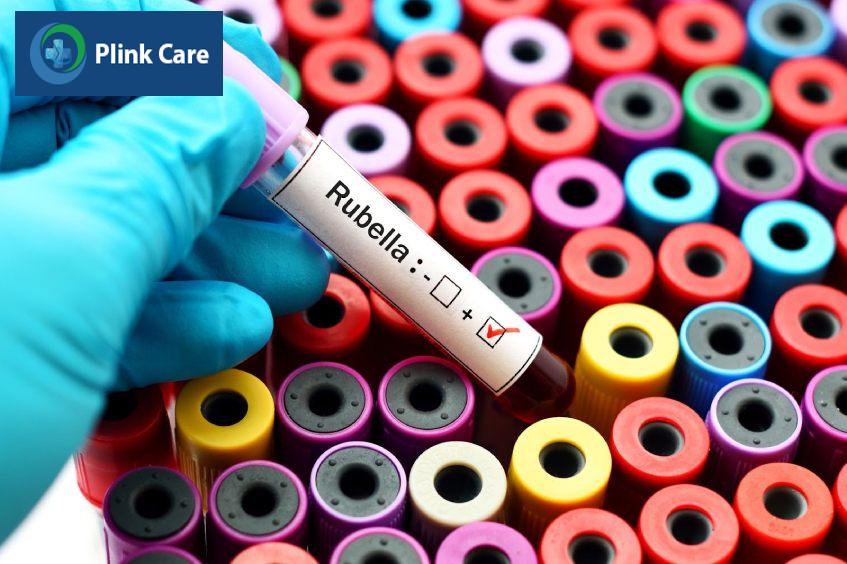 ý nghĩa kết quả xét nghiệm rubella