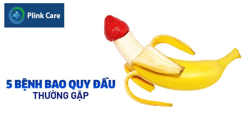 bao quy đầu