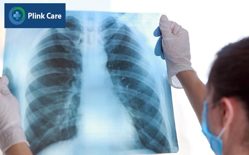 biện pháp kiểm soát đau
