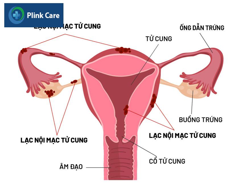 cơ quan sinh sản của bệnh nhân