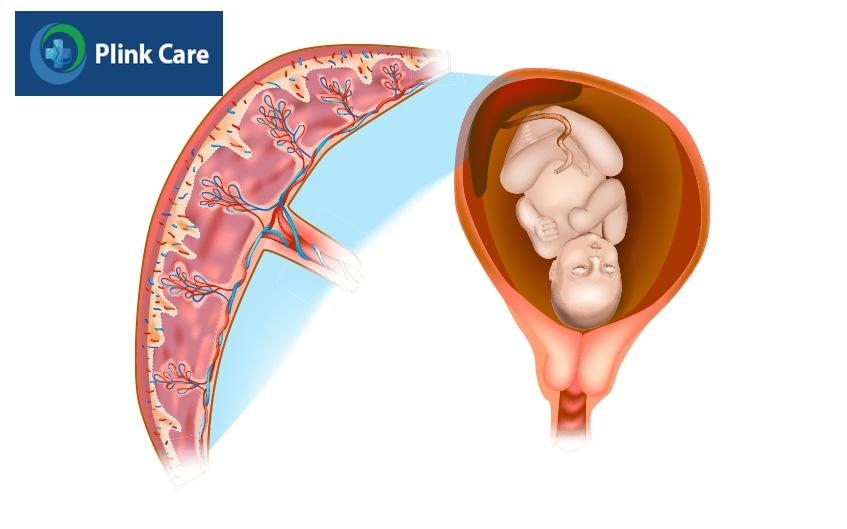 nên làm gì khi nồng độ hcg quá thấp