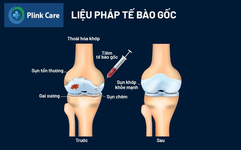 nguyên lý hoạt động của tế bào gốc