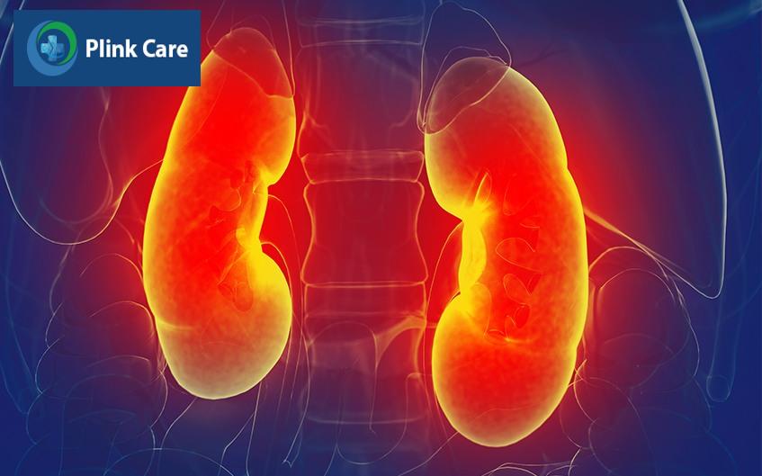 Viêm cầu thận lupus là gì