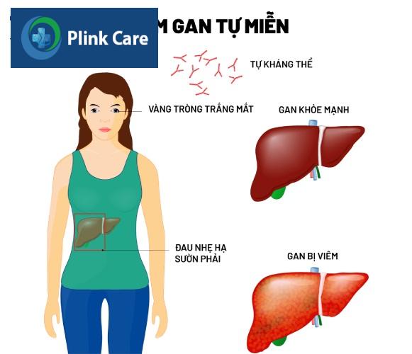 xét nghiệm viêm gan tự miễn