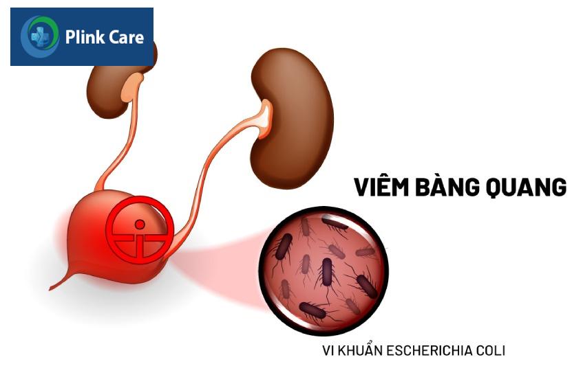 yếu tố vi sinh vật