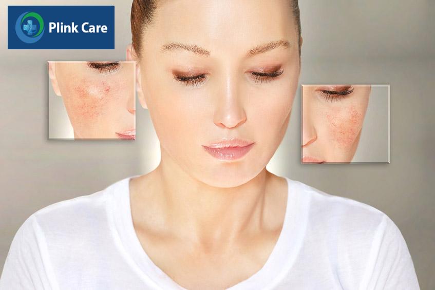cải thiện sức khỏe tinh thần