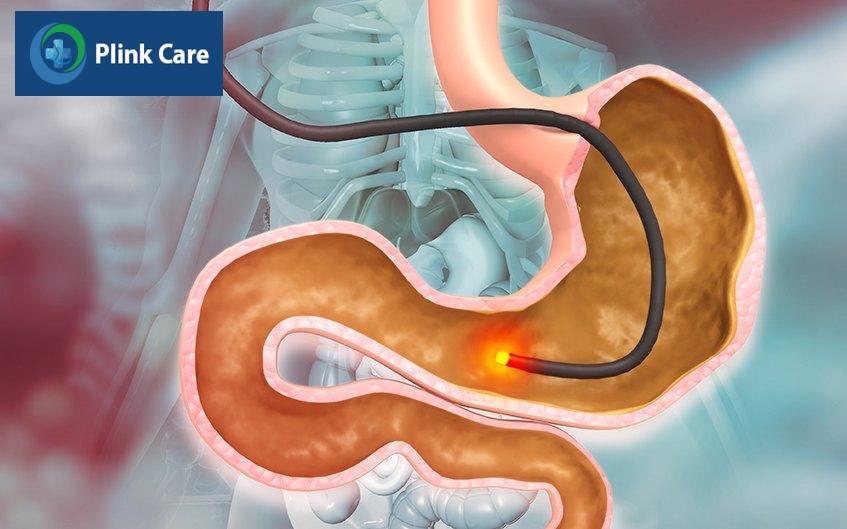 cơ chế bệnh sinh của loét dạ dày tá tràng