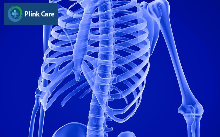 dinh dưỡng cho người bị gãy xương sườn
