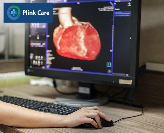 kỹ thuật chụp ct tầm soát đột quỵ tim