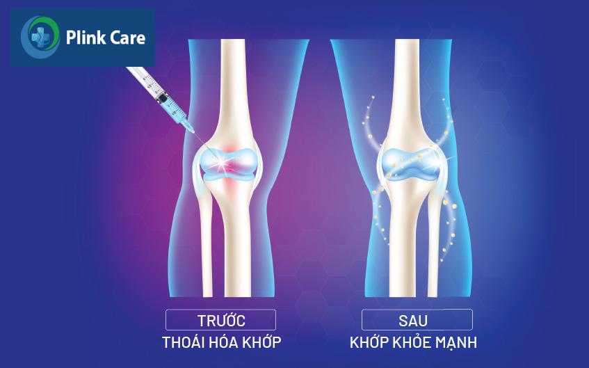 kỹ thuật tiêm thuốc vào khớp gối