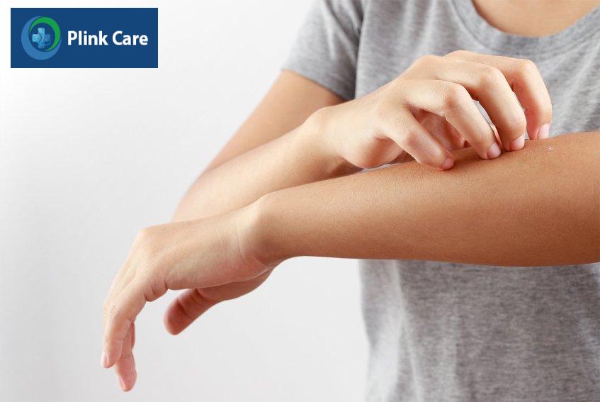 Ngứa là một trong số những triệu chứng của men gan cao.