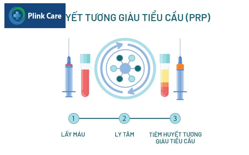 tiêm prp vào khớp