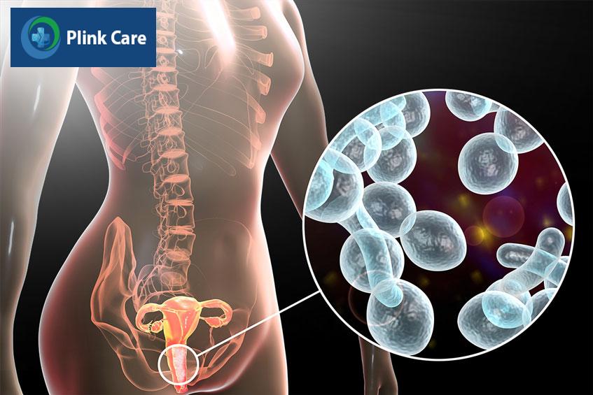 âm đạo tiết dịch bất thường