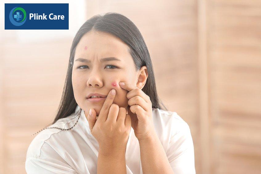 ăn nhiều đường dễ nổi mụn trứng cá