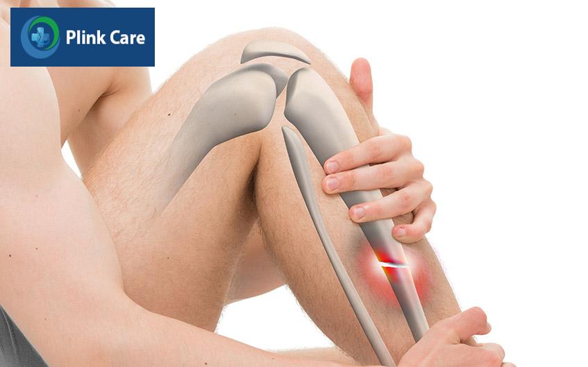 các loại gãy xương