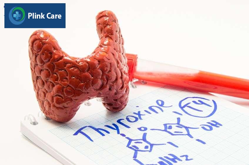 cách điều trị bướu cổ theo khoa học