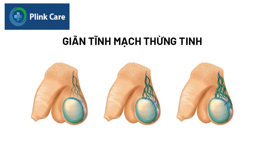 chẩn đoán 