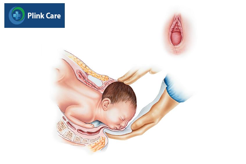 chấn thương trong quá trình sinh nở