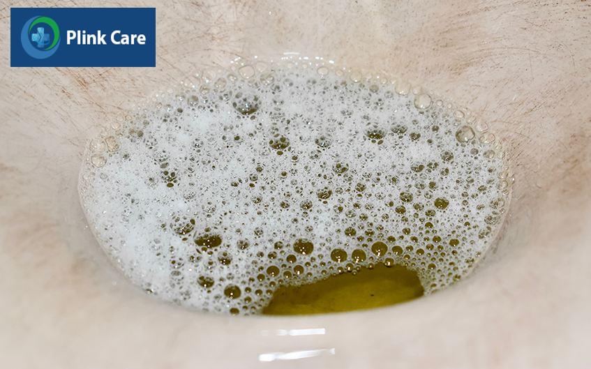 dấu hiệu viêm cầu thận cấp