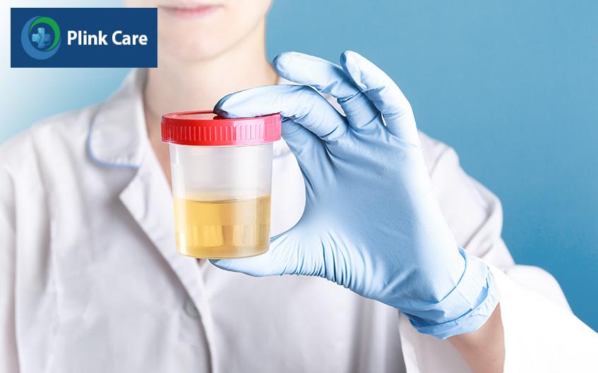 điều trị lupus khi mang thai