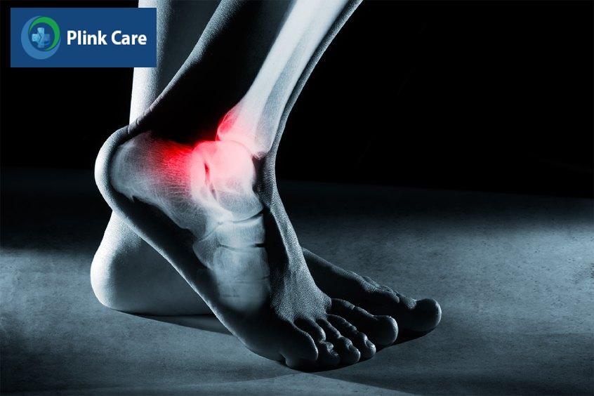hình ảnh siêu âm khớp cổ chân chẩn đoán bệnh gì
