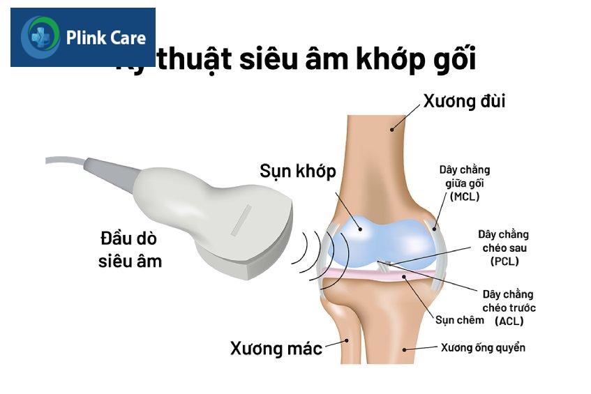 kỹ thuật siêu âm khớp gối