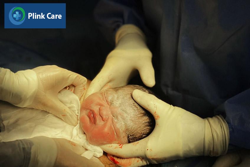 mổ lấy thai cho mẹ bầu bị nhau cài răng lược