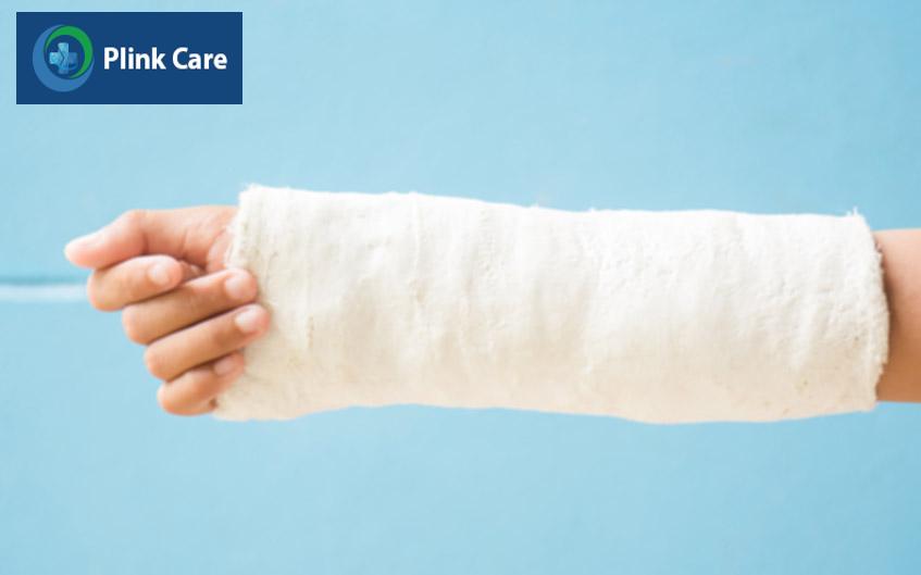 phương pháp bó bột