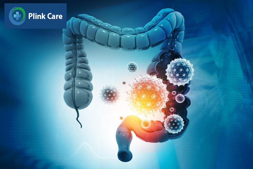 siêu âm đại tràng chẩn đoán bệnh gì