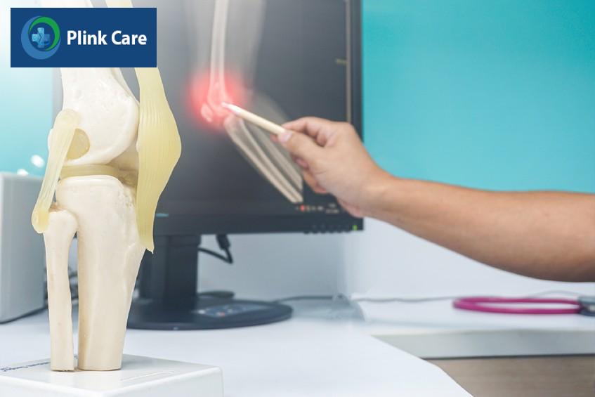 siêu âm tràn dịch khớp gối