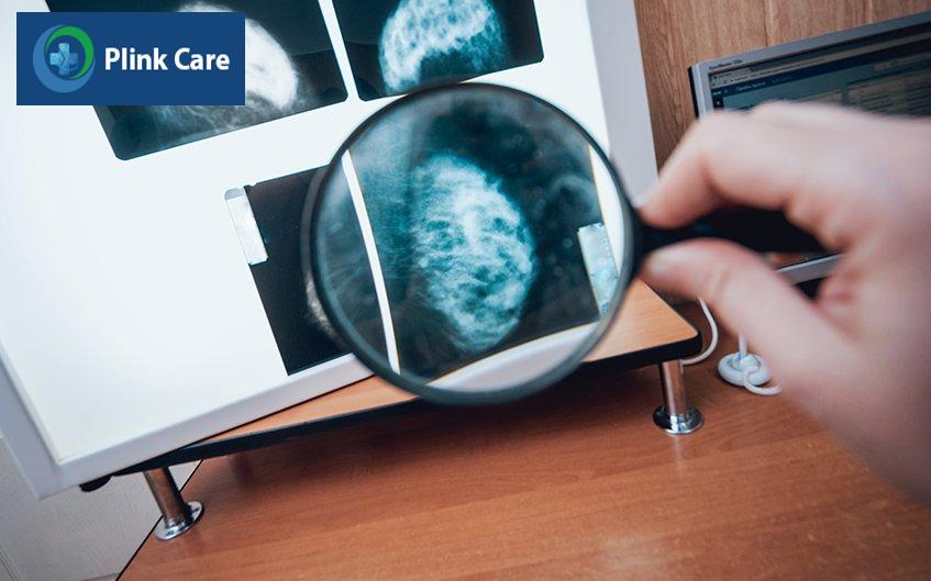sinh thiết vú bao lâu có kết quả