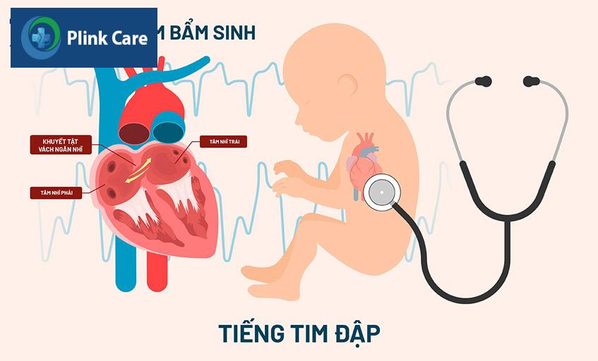 tiền căn của bệnh hở van ba lá