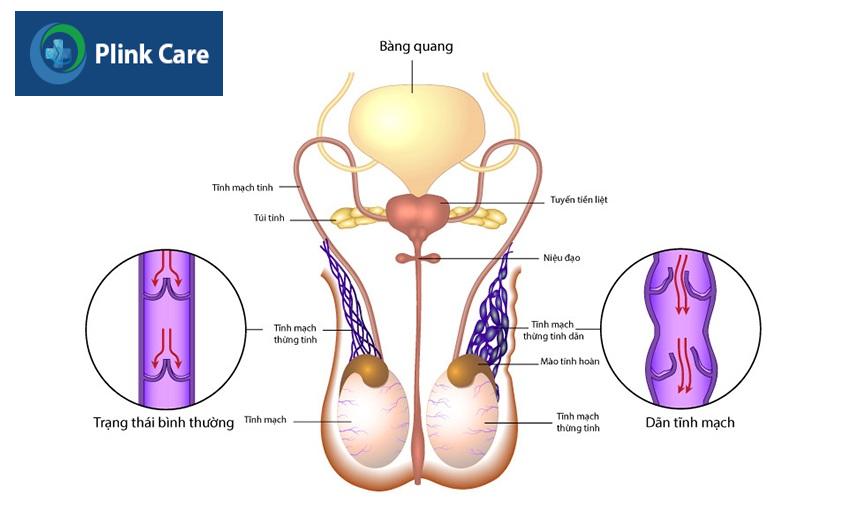 tổng quan về bệnh
